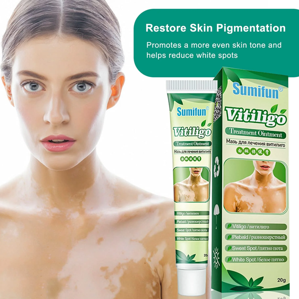 Sumifun Vitiligo Cream