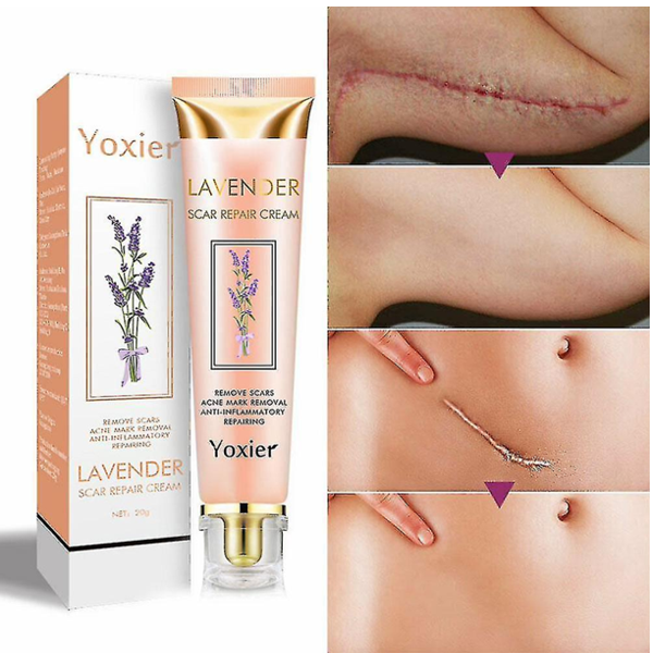 Yoxier Lavender Scar Repair Cream